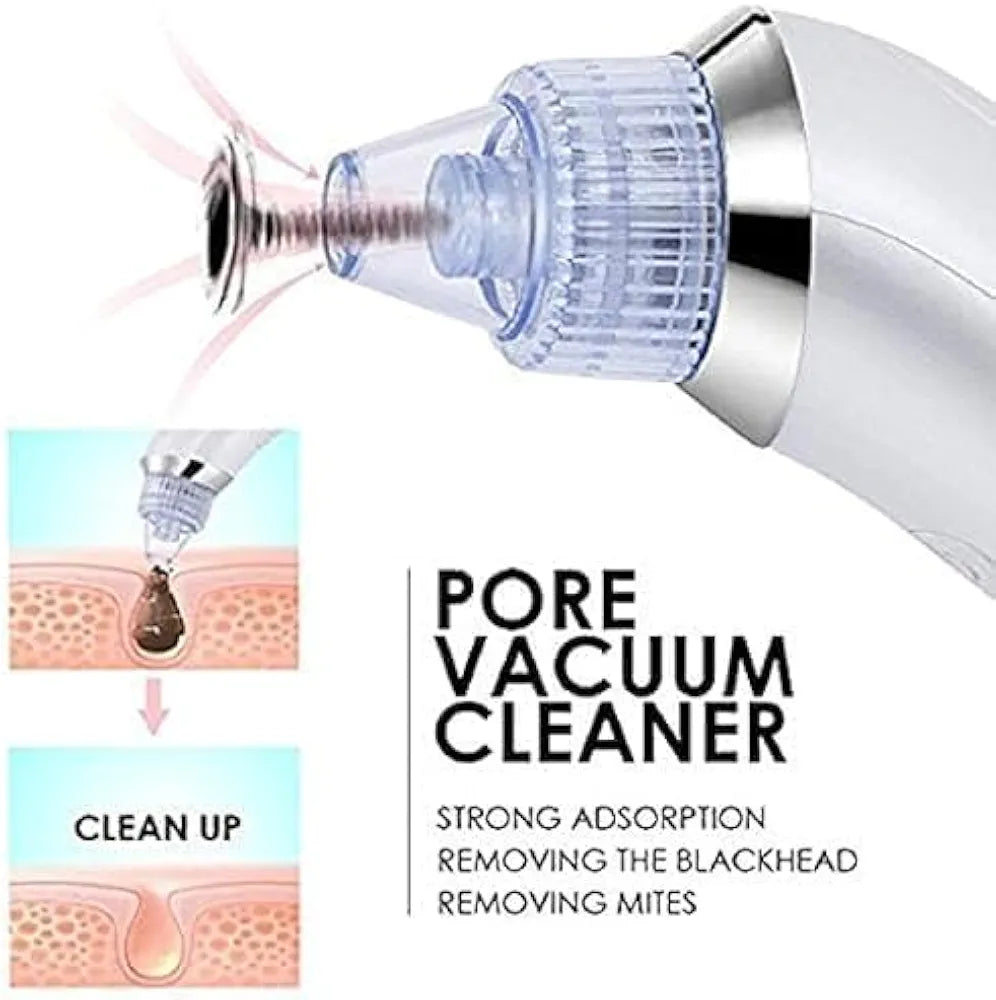Blackhead remover