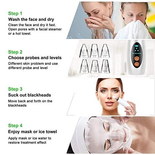 4-in-1 Blackhead Remover Vacuum – Electric Pore Cleaner with Adjustable Suction & Interchangeable Heads - Facial Device for Men & Women (Blue)