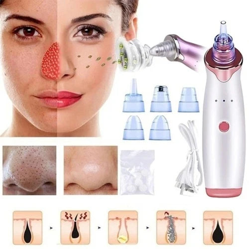 4-in-1 Blackhead Remover Vacuum – Electric Pore Cleaner with Adjustable Suction & Interchangeable Heads - Facial Device for Men & Women (Blue)
